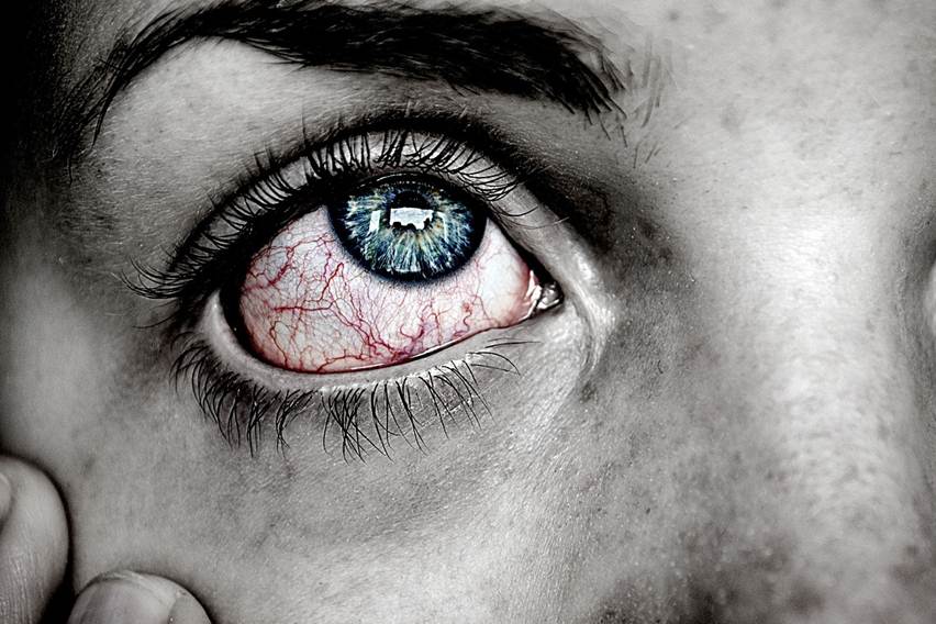 Mencegah Penyakit Mata agar Tidak Menular